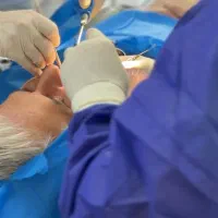 ایمپلنت یک روزه دیجیتالی