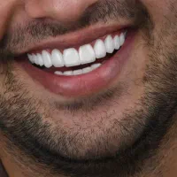 ایمپلنت دیجیتال