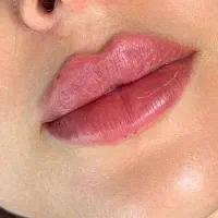 جشنواره بهاره/تزریق ژل/بوتاکس/فیلربادی بامواد اصل