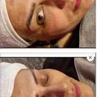 پاکسازی پوست رشت، فیشیال رشت،پاکسازی صورت رشت|خدمات آرایشگری و زیبایی|رشت, گلسار|دیوار