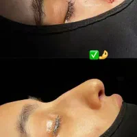 جشنواره جراحی و عمل بینی در کرج|خدمات آرایشگری و زیبایی|چهارباغ, |دیوار