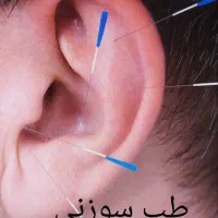 خدمات طب سنتی و شکسته بندی