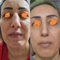 صورتی صاف و یکدست با محصولات گیاهی