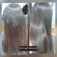 ۴۲۰ ت پروتویئن تراپی و موخوره گیری و درمان