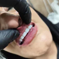 دندان مصنوعی وارداتی هر فک ۵ تومان|خدمات آرایشگری و زیبایی|کرج, کمالشهر|دیوار