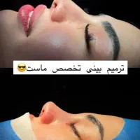 تخفیف عمل بینی لیپو ابدو لیفت ابرو وکاشت ابرو و مو|خدمات آرایشگری و زیبایی|اسلامشهر, شهرک لاله|دیوار