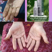 نانووگان نقره نرم کننده وترمیم کننده|آرایشی، بهداشتی، درمانی|مرودشت, فاز دوم شهرک فرهنگیان|دیوار