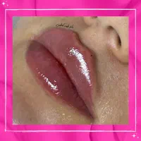 تخفیفات 50% دکتر کاظمی، بوتاکس فیلر مزو ژل لب روسی|خدمات آرایشگری و زیبایی|مشهد, احمدآباد|دیوار
