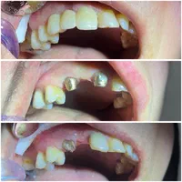 خدمات دندانپزشکی|خدمات آرایشگری و زیبایی|رشت, گلسار|دیوار