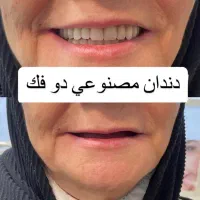 ساخت و تعمیر دندان مصنوعی/مواد آلمانی/نقد و اقساط|خدمات آرایشگری و زیبایی|چناران, |دیوار