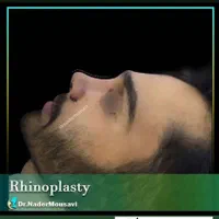 جراحی زیبایی بینی ،گچساران،دکتر نادر موسوی|خدمات آرایشگری و زیبایی|دوگنبدان, |دیوار