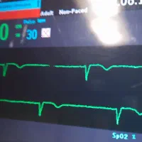 تزریقات در منزل