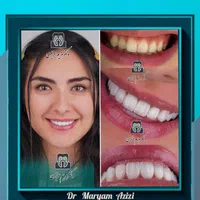 مرکز تخصصی دندانپزشکی عصب کشی دندان پزشکی
