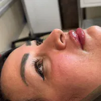 آموزش تزریق ژل به طور کامل|خدمات آموزشی|ساری, |دیوار