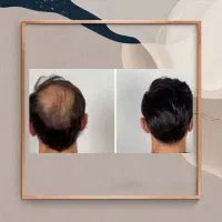 تو هر سنی باشی درمان میشی