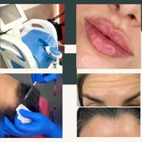 مطب مزو ، بوتاکس ، ژل لب روسی ، فیلر ،آنزیم