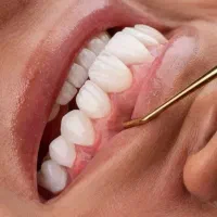 دندانپزشکی اقساط ۶ماهه بدونِ کارمزد
