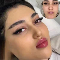 مرکز زیبایی بوتاکس و فیلر و تمامی خدمات زیبایی|خدمات آرایشگری و زیبایی|اصفهان, ملکشهر|دیوار