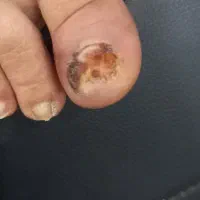 کلینیک تخصصی زخم|خدمات آرایشگری و زیبایی|فولادشهر, B2|دیوار