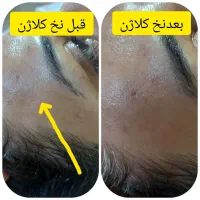 پاکسازی رایگان|خدمات آرایشگری و زیبایی|مشهد, ایثار|دیوار