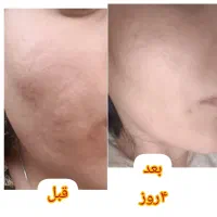 انواع سرم