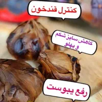 چربیهات را بسوزانید،بدون رژیم سخت با سیر سیاه|خوردنی و آشامیدنی|شیراز, طلاب|دیوار