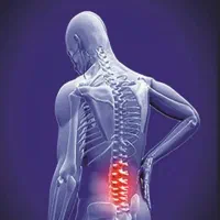 اصلاح دیسک کمر بدون عمل