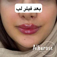 جشنواره لیزر موهای زائد،ژل،بوتاکس..