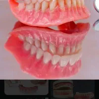 دندانسازی مصنوعی متحرک