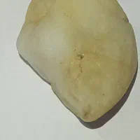 راف الماس استخوانی