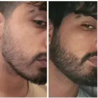 اعتماد به نفس بالا با ریشای پرپشت