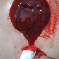 حجامت|خدمات پیشه و مهارت|زاهدان, |دیوار