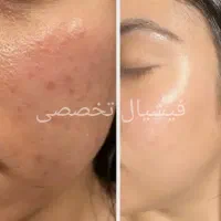 رنگ و کوتاهی و احیا و ابریشم سازی مو تخصصی|خدمات آرایشگری و زیبایی|بندرعباس, |دیوار