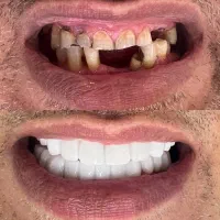 تخفیف دندانپزشکی