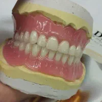 ساخت انواع دست دندان (پروتز متحرک)