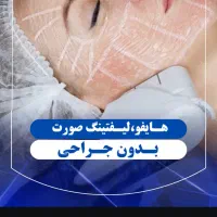 هایفوتراپی صورت. رفع غبغب. لاغری با قیمت ۲۵۰۰|خدمات آرایشگری و زیبایی|شاهین‌شهر, خانه کارگر|دیوار
