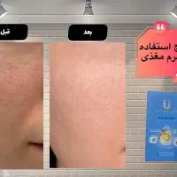 اکسیرجوانی|آرایشی، بهداشتی، درمانی|تالش, هشتپر|دیوار