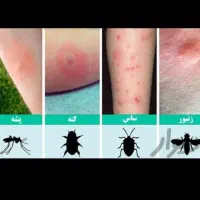 سمپاشی سوسک ساس سم پاشی مورچه طعمه گذاری موش|خدمات نظافت|ری, شهادت|دیوار