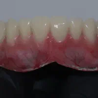 لابراتور دندانسازی خیریه حضرت فاطمه|خدمات آرایشگری و زیبایی|تهران, شهرک طالقانی|دیوار