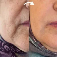 جوانساز بیوممتیک با تخفیف باورنکردنی