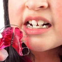 ارتودنسی مطب ماه|خدمات آرایشگری و زیبایی|تهران, عباس‌آباد|دیوار