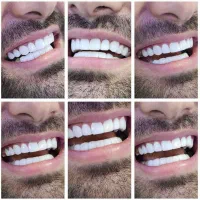 آموزش دندانسازی برای مهاجرت