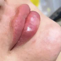 تزریق ژل و بوتاکس تخصصی|خدمات آرایشگری و زیبایی|اندیشه, اندیشه فاز ۱|دیوار