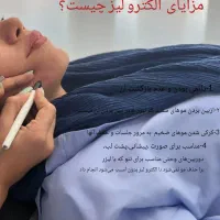الکترو لیز