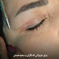 جراحی بینی ، کاشت مو، ایمپلنت، کامپوزیت|خدمات آرایشگری و زیبایی|تهران, یوسف‌آباد|دیوار