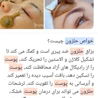 فروش حلزون آلبینو|خزنده|آبادان, |دیوار