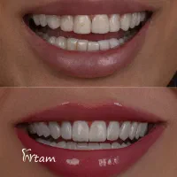 دندان پزشکی آرتام