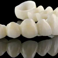 تمامی خدمات دندانپزشکی نقدی و چکی بدون سود