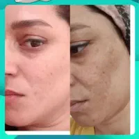 نمایندگی رویال دریاسوج ببرراضی نبودی پس میگیریم|آرایشی، بهداشتی، درمانی|دوگنبدان, |دیوار