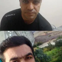 کاشت مو وابرو تبریز بدون جراحی تضمینی باتخفیف ویژه